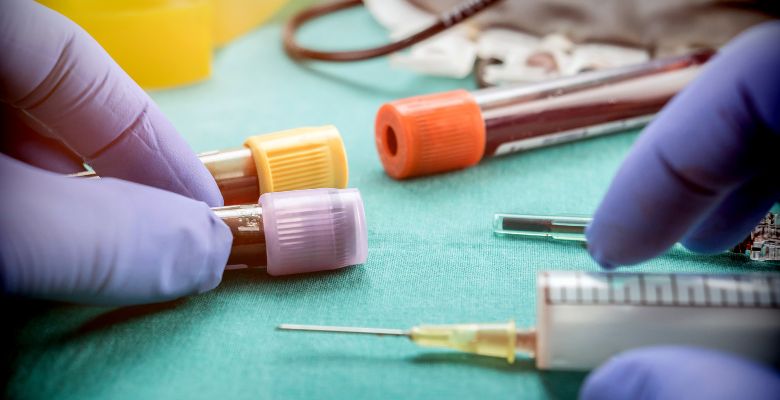 Biomarcador no sangue pode identificar resistência à insulina no cérebro