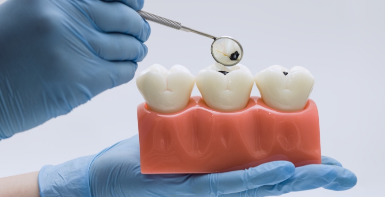 Saúde oral ganha peso na prevenção da diabetes